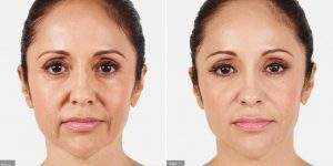 skin specialist in Jaipur