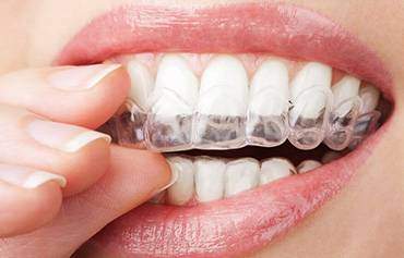 The health benefits of straight teeth